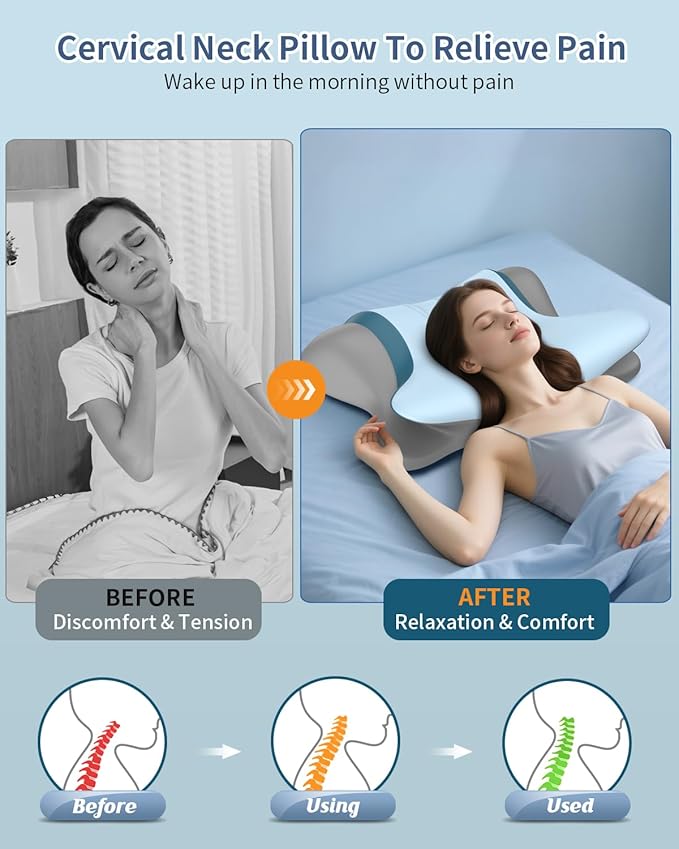 Cervical Neck Pillow for Pain Relief - Image 2